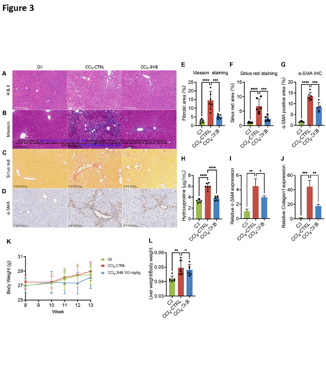 Yudian ZhangKetone body 3-hydroxybutyrate alleviates CCl4-induced liver fibrosis in Page14